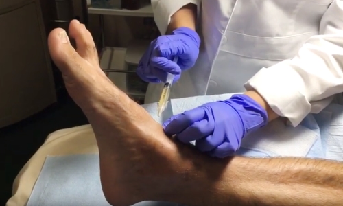 ankle pain treatment
